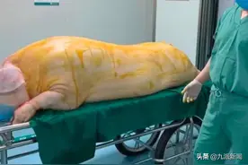 烧伤病人手术移植猪皮惹争议，医院回应：取皮后猪被拉到屠宰场图片