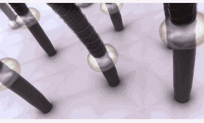 鏌撳彂鍚庡ご鍙戝眳鐒惰繕瓒婃潵瓒婇『婊戯紵澶氫簭杩欎釜鈥滃浐鑹插皬褰╃摱鈥? onerror=