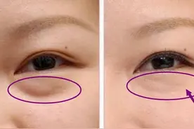 生活小妙招：轻松去除眼袋！让您越来越美图片