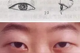 做好这五件事，肿泡眼去无踪图片