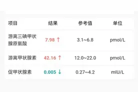 甲状腺功能报告单，看哪几项指标确定甲减和甲亢？大夫教你图片