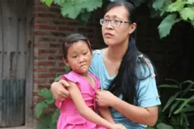 妈妈无知夺走女儿一张脸，6岁女童渴望摘下“面具”，让人痛心图片