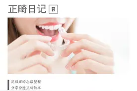 正畸日记｜正畸神器大种草图片