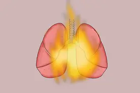 后背总容易长痘痘，是咋回事？皮肤科主任为你抓出“祸根”图片