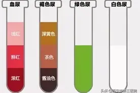 健康提醒 | “五颜六色”的尿透露健康的密码（下篇）图片