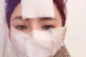 阿娇撞伤头缝上百针后，张柏芝也晒满脸纱布照，网友忙问受伤了？图片