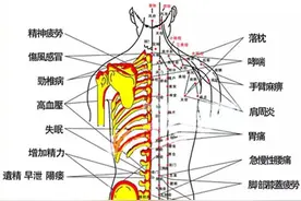 拔罐后的罐印都暗示了啥？图片