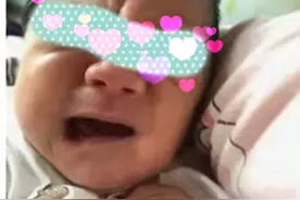 【罕见病】宝宝哭泣时表情搞怪，这种疾病了解一下【呱呱教·150】图片