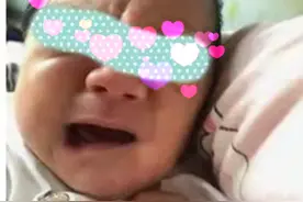 【罕见病】宝宝哭泣时表情搞怪，这种疾病了解一下【呱呱教·150】图片