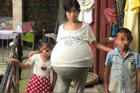 2年时间女子肚子疯长成巨球，每晚坐着睡觉，背后的故事心酸又温暖图片
