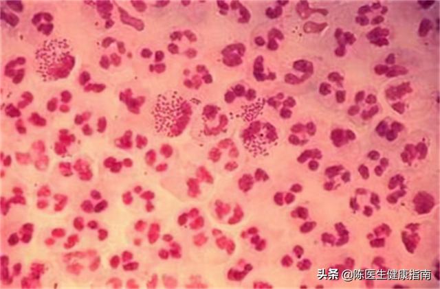 阿莫西林不是万能“消炎药”，只适用于这5类疾病，可别随意乱吃