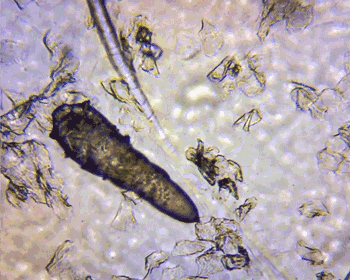 火爆INS的芝士皂，洗脸就像敷面膜，痘痘，黑头，螨虫全都消失了