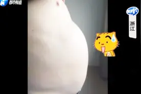 浙江大哥体重暴增至200斤，肚子比孕妇还大，检查结果让人傻眼视频封面