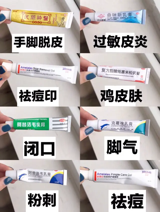 复方醋酸地塞米松乳膏能鸡皮肤