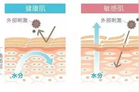 我经常过度敏感，是病吗？图片