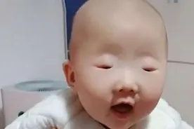 全网眼睛最小宝宝火了，网友：见过眼小的，没见过这么小的图片