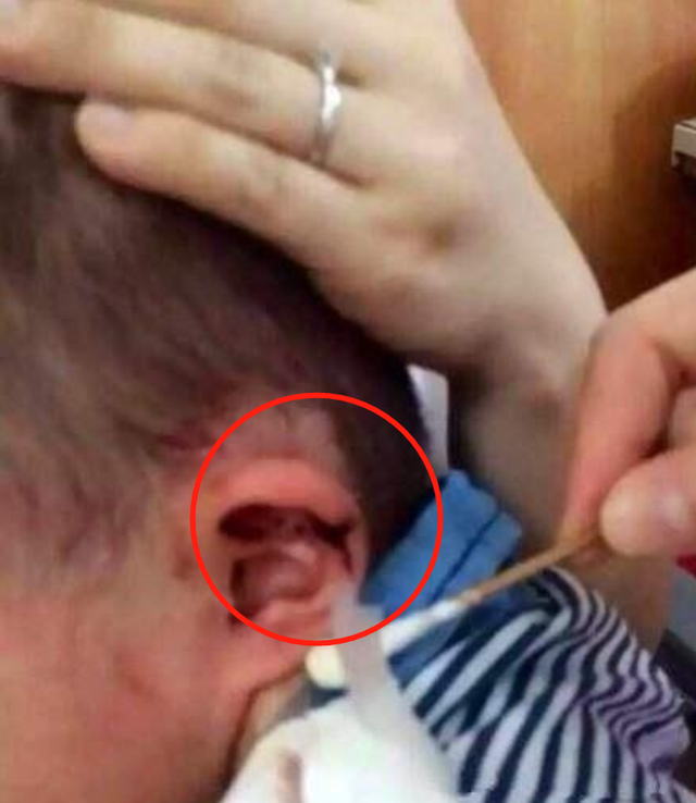 宝宝腿上长的像鸡皮疙瘩一样的东西