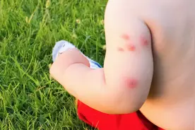 夏天来了，孩子能用电蚊香液吗？有什么风险？图片