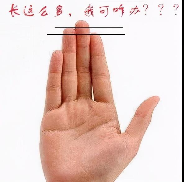 最近有网友留言:在上看到有类似的文章"男性无名指长容易得前列腺癌"