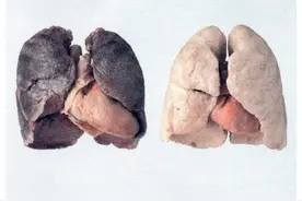 吸烟为何肺会变黑，戒烟后肺还能变粉吗？戒烟多久肺功能可以恢复图片
