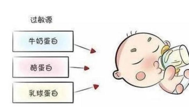 牛奶蛋白过敏的处理