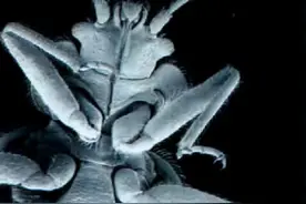 带你了解枕边的“吸血怪”：床虱图片