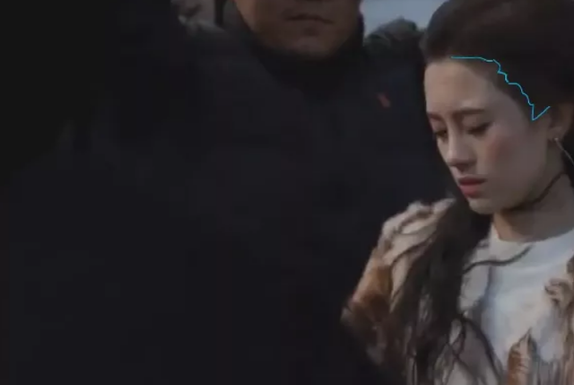 耳朵前鬓角下鸡皮疙瘩红印