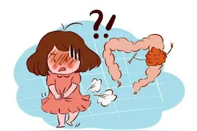 大便频率异常，或是肠癌来袭？医生：或许更该留意3种异常大便图片