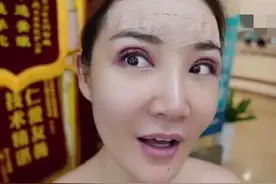 央视女主播自曝整容？晒割双眼皮手术全过程，做完连夸自己变年轻图片