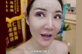 央视女主播自曝整容？晒割双眼皮手术全过程，做完连夸自己变年轻图片