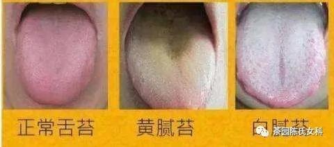 备孕可以喝土茯苓花胶煲汤吗 2026年备孕能不能吃土茯苓煲汤喝