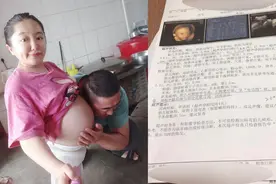 袖珍女孩怀孕后被查出胎儿畸形，拒绝医生为她引产：我想当妈妈图片