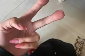 女票发来照片，跟我说手指被夹成这样了...你们帮我看看能信吗图片