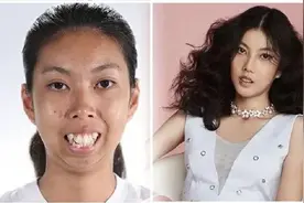 “你的钢牙，真可爱！”泰国人就爱戴牙套？原因找到了…图片