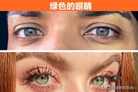 ​只有在少数人的身体上，可以看见的8个与众不同的特征图片