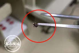 南昌女子骑电动车，虫子被吹进耳朵！结果在里面住了下来图片