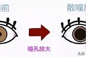 福州5岁男孩150度近视，药水一滴近视度数“消失”了！这是什么神操作？图片