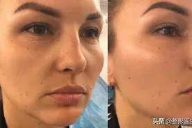 40岁后面部抗衰，这些“坑”要避而远之图片