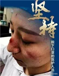 红斑角化症注意什么