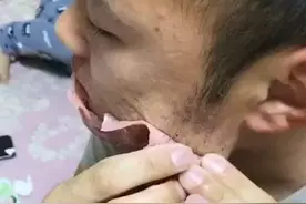 天津一女子用蜜蜡给老公拔胡子：没想到这么疼，想哭又想笑图片