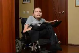 世界上首个想做换头手术的人，他现在怎么样呢？图片