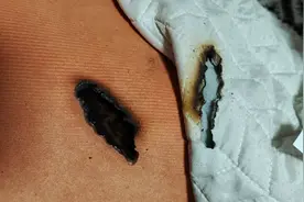 防火小tips-“纵火犯”竟然是太阳图片