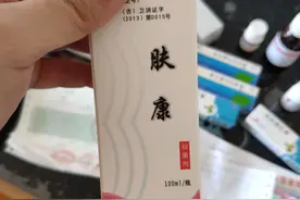 一个男孩子的牛皮癣（银屑病）治疗之路图片