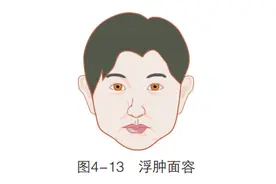 「观面无隐私」很多种异常面容都是病图片