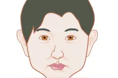 「观面无隐私」很多种异常面容都是病图片