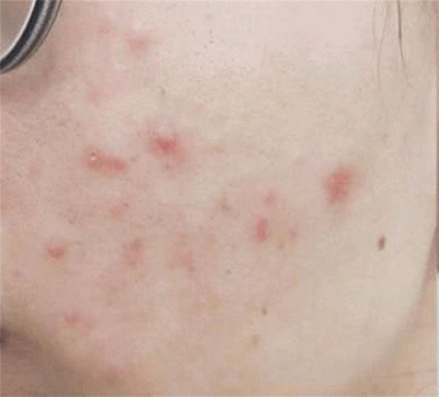 一张干净的脸，是女人最直接的吸引力