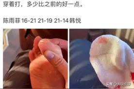 全运会穿李宁鞋比赛被割伤流血！奥运冠军表态，李宁官方拒绝回应图片