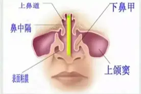 耳鼻喉科医生告诉您，鼻孔里的小红球是什么？图片