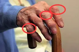 这些中药最擅压制游走性疼痛！中医坦言：但对毒性得了然于心图片