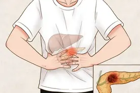 腹泻入院查出胰腺癌，出现这些症状千万不能掉以轻心图片